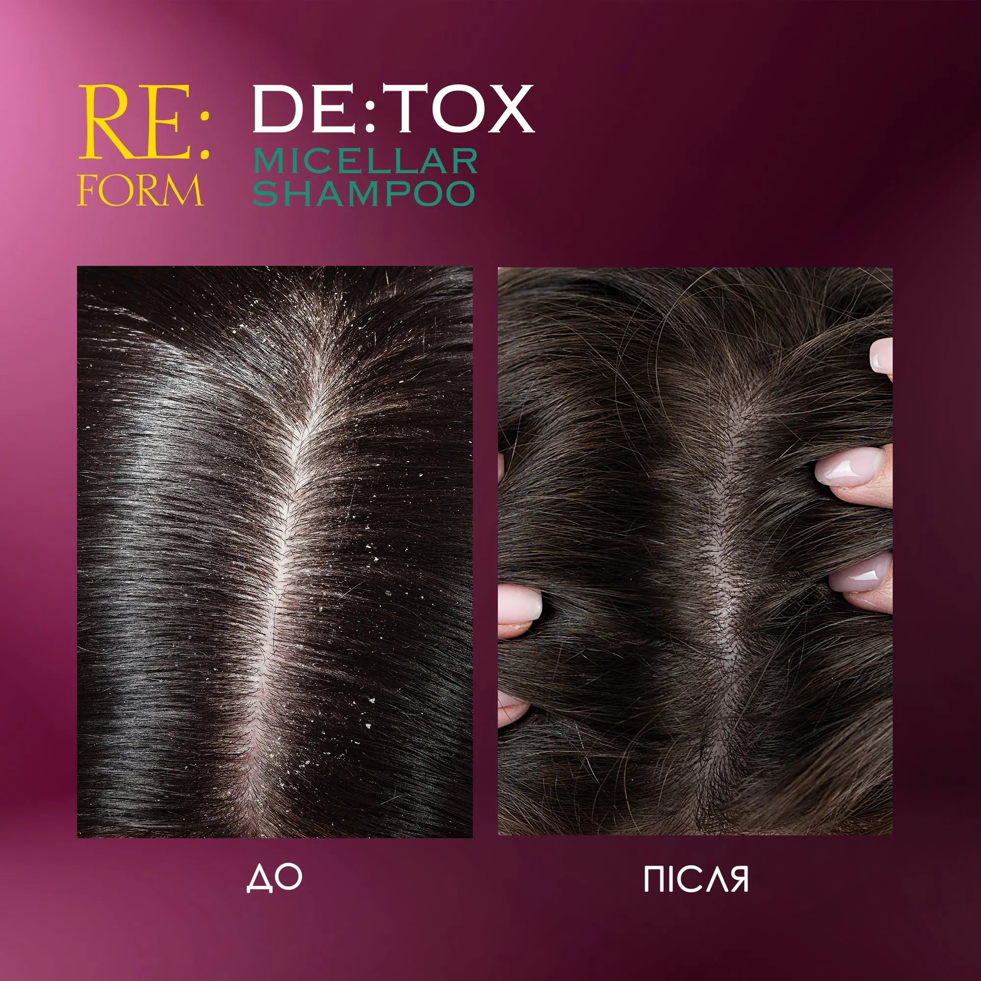 Micellar shampoo DE:TOX RE:FORM, 400 ml Фото №10